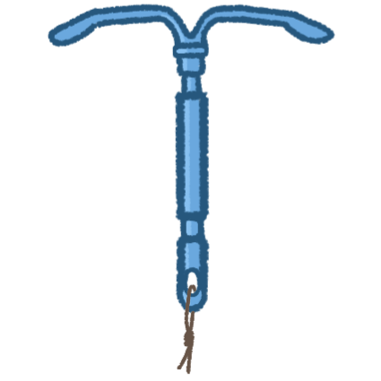 A blue plastic T shaped intrauterine device, it has a small brown string tied through the loop at the bottom.